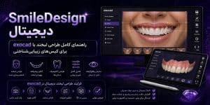 SmileDesign دیجیتال — راهنمای کامل طراحی لبخند با exocad برای کیس‌های زیبایی‌شناختی