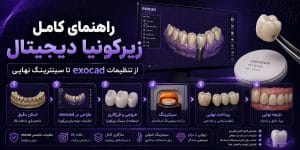 راهنمای کامل زیرکونیا دیجیتال — از تنظیمات exocad تا سینترینگ نهایی