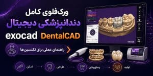 ورک‌فلوی کامل دندانپزشکی دیجیتال با exocad DentalCAD — راهنمای عملی برای تکنسین‌های ایرانی